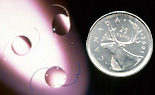 Intraocular Lens Impants IOL