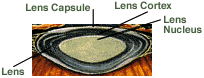 Diagram of the Lens Capsule